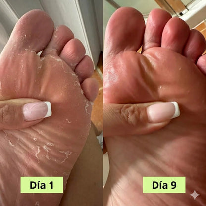 lociena Purificante Antifúngico